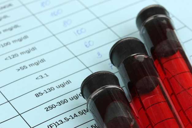 Metoprolol im blut nachweisbar